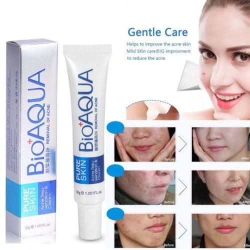 Bio aqua Acne Cream Face Skin Care